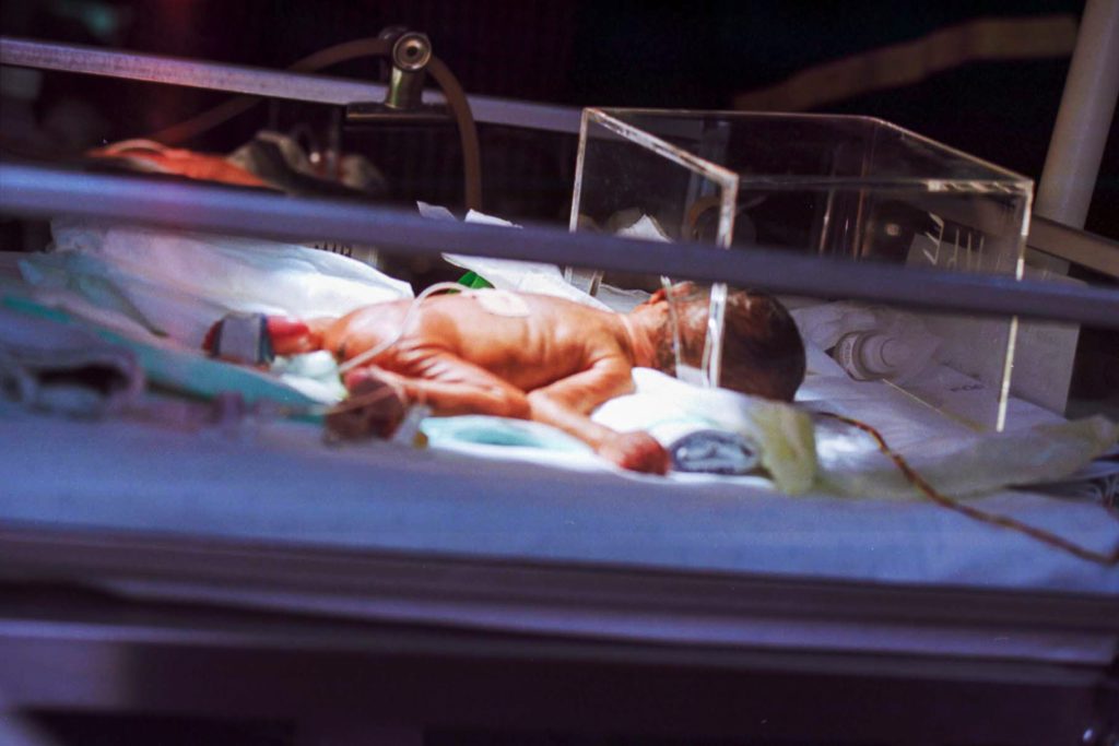 When a preemie is born so early that he needs to have care in NICU, the stress and trauma can cause PTSD in parents.